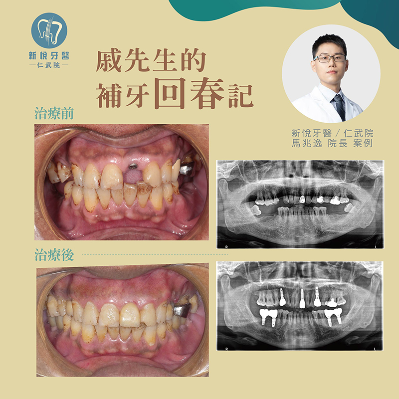 新悅美學牙醫診所的案例分享圖片